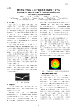 眼球運動を考慮した OCT 断面画像の位置合わせ手法 Registration