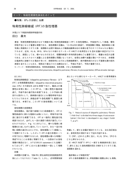 特発性肺線維症（IPF）の急性増悪