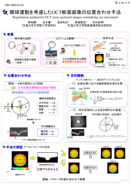 眼球運動を考慮したOCT断面画像の位置合わせ手法