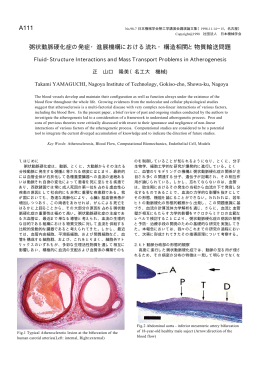 A111 粥状動脈硬化症の発症・進展機構における流れ