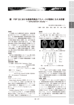 FBP 法における画像再構成パラメータが画像に与える影響 〜 simulation