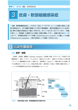 2 皮膚・軟部組織感染症