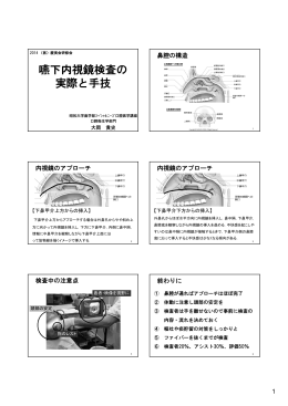 嚥下内視鏡検査の 実際と手技