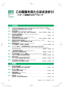 この画像を見たらほぼ決まり！ パターン認識からのアプローチ