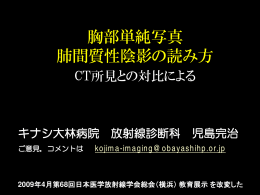 胸部単純写真 肺間質性陰影の読み方