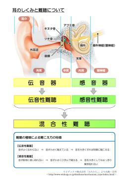 伝 音 器 感音性難聴 伝音性難聴 感 音 器 混 合 性 難 聴