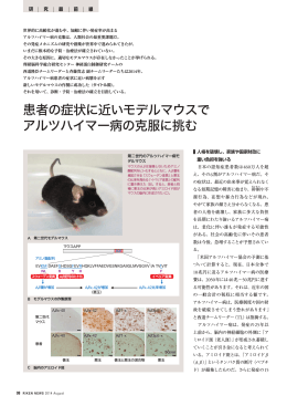 患者の症状に近いモデルマウスで アルツハイマー病の克服に挑む