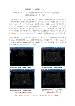 画像拡大と画質について 佐々木 博
