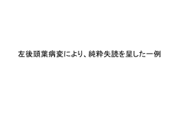 左後頭葉病変により、純粋失読を呈した一例