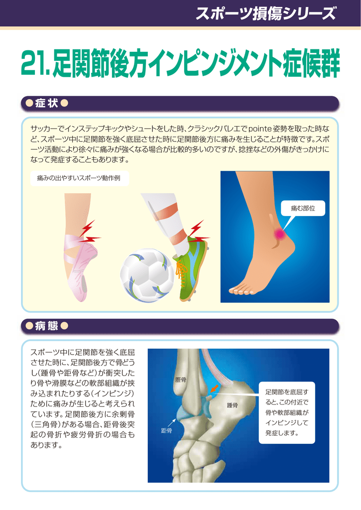 21 足関節後方インピンジメント症候群