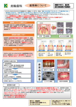 歯周病について－（クリックするとPDFでご覧いただけます）