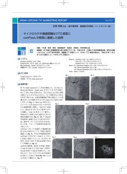 マイクロカテが通過困難なCTO 病変に canPass が