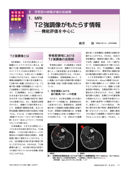 T2強調像がもたらす情報 機能評価を中心に