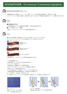 経皮的血管形成術 Percutaneous Transluminal Angioplasty