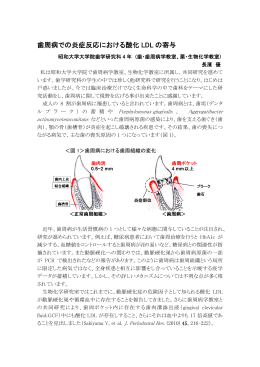 歯周病での炎症反応における酸化 LDL の寄与