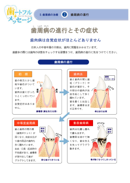 歯周病の進行とその症状