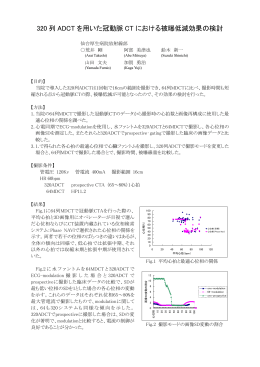 320 列 ADCT を用いた冠動脈 CT における被曝低減効果の検討