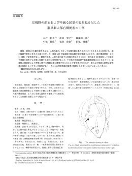 左視野の顔面および単純な図形の変形視を呈した 脳梁膨大部 - J