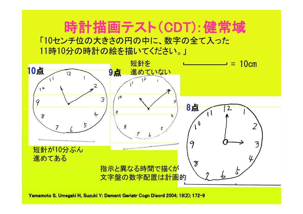 時計描画テスト Cdt 健常域