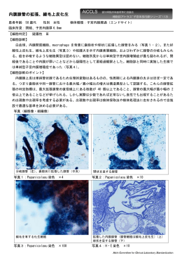内膜腺管の拡張、線毛上皮化生 - 公益社団法人 愛知県臨床検査技師会
