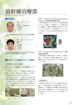 放射線治療部 - 栃木県立がんセンター