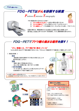 FDG－PETは がんを診断する検査