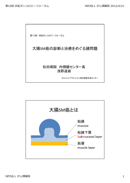 大腸SM癌とは - NPO法人 がん情報局
