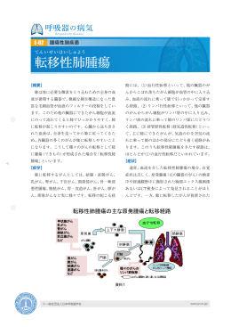 転移性肺腫瘍 - 日本呼吸器学会