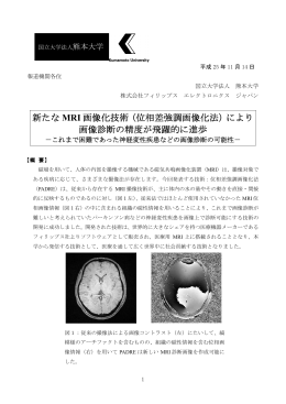 新たな MRI 画像化技術（位相差強調画像化法）により 画像