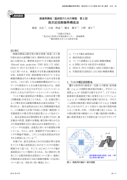逐次近似画像再構成法