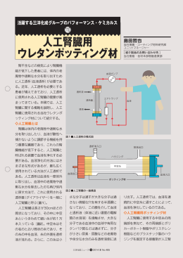 人工腎臓用 ウレタンポッティング材