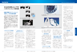 きらめきを実現したレグザの ハイダイナミックレンジ表示技術