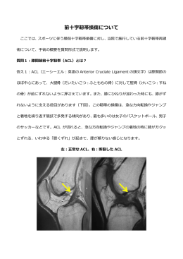 前  十字靭帯損傷について