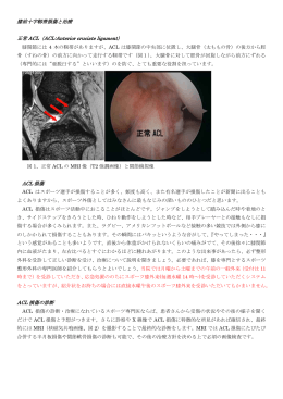 膝前十字靱帯損傷と治療 正常 ACL（ACL:Anterior cruciate ligament