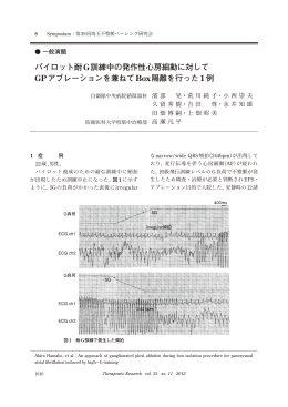 パイロット耐G訓練中の発作性心房細動に対して GPアブレーションを兼ね