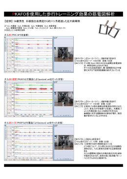 PKAFOを使用した歩行トレーニング効果の筋電図解析（PDF：331KB）