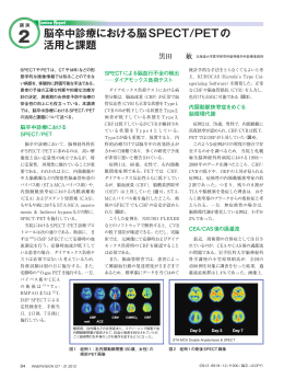 脳卒中診療における脳SPECT/PETの 活用と課題