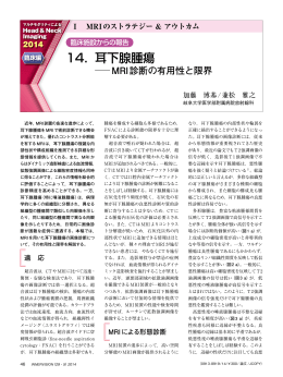 14．耳下腺腫瘍
