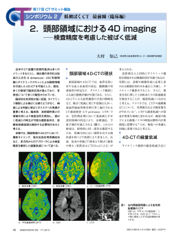 2．頭部領域における4D imaging