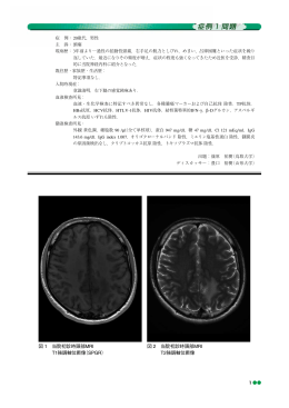 図 1 当院初診時頭部MRI T1強調軸位断像