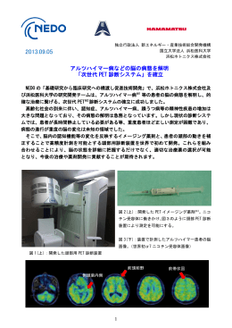 「次世代 PET 診断システム」を確立