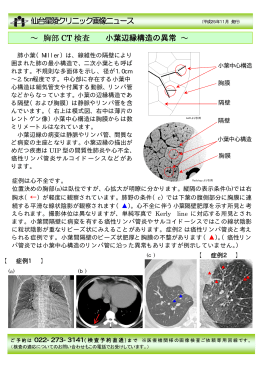仙台星陵クリニック画像ニュース ～ 胸部 CT 検査 小葉辺縁構造の異常 ～