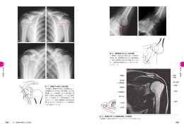 ・・・165 図 11 肩関節下方負荷 X 線正面像 18 歳男性，肩関節不安定症