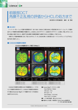 前眼部OCT 角膜不正乱視の評価からHCLの処方まで