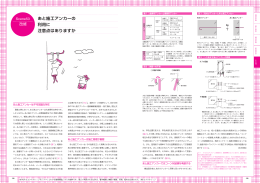 あと施工アンカーの利用に注意点はありますか