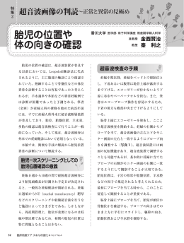 胎児の位置や 体の向きの確認
