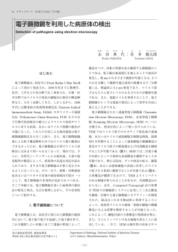 電子顕微鏡を利用した病原体の検出