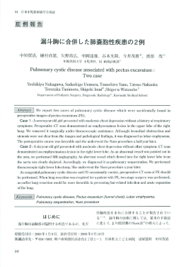 漏斗胸に合併した肺嚢胞性疾患の2 例