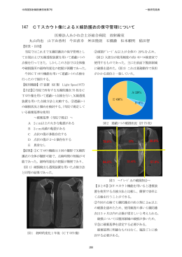 147 CTスカウト像によるX線防護衣の保守管理について
