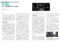 新しい関節軟骨のMRI評価法-T2マッピング / T1&rho;
